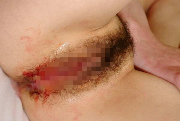 生理中のおまんこ画像！血があるので閲覧注意ですｗ 61 img 697888d68317f