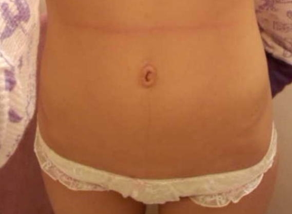 女の子のお腹周りに興奮しちゃう人向けのエロ画像!へそに指入れたいw 288 女の子のお腹周りに興奮しちゃう人向けのエロ画像!へそに指入れたいw 287 img 6941462014074